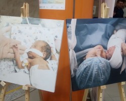 Х съезд гинекологов, акушеров, неонатологов Республики Беларусь Х съезд гинекологов, акушеров, неонатологов Республики Беларусь